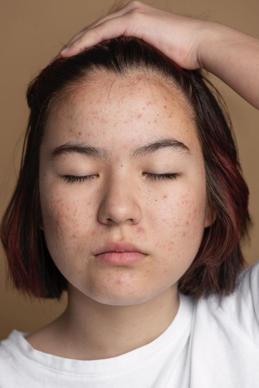 ✅ 5 Signs Your Skin Needs a Deep Clean